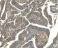Anti-EEF2 Picoband™ Antibody (monoclonal, 5F5)